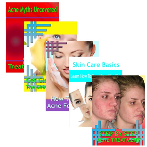 Beating Acne: 5 Guides Collection Access