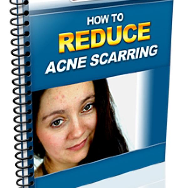 Comprehensive Guide to Reducing Acne Scarring